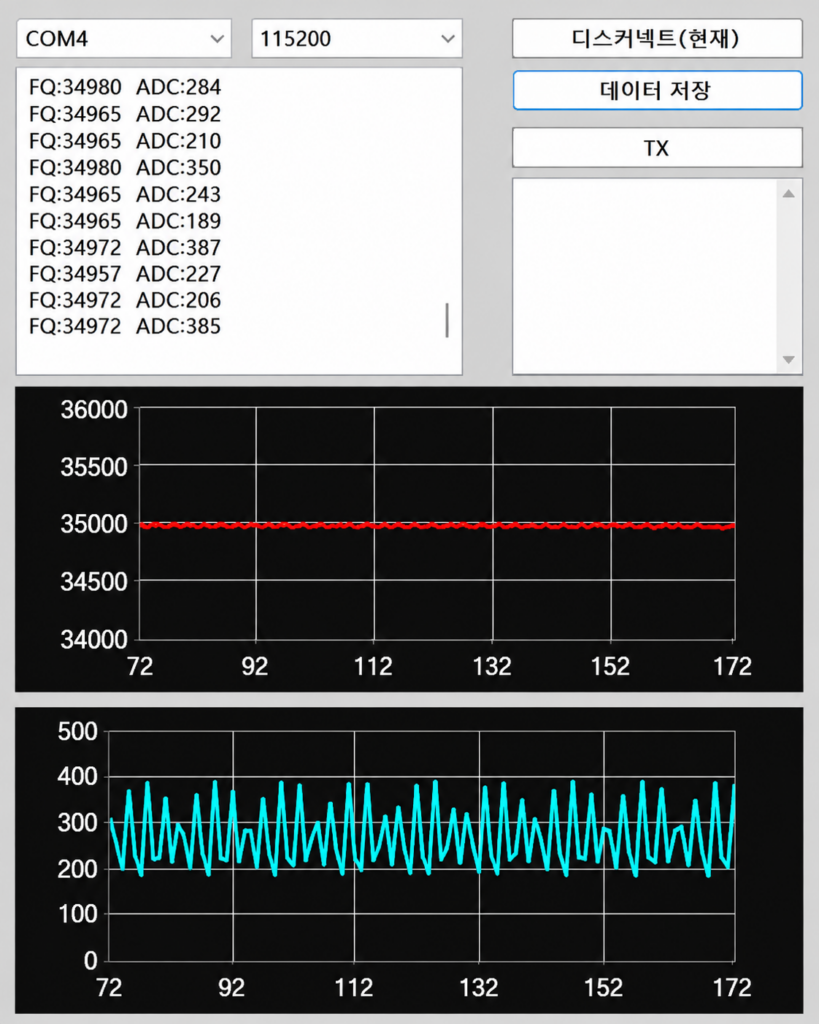 Ultrasonic Screening Monitoring